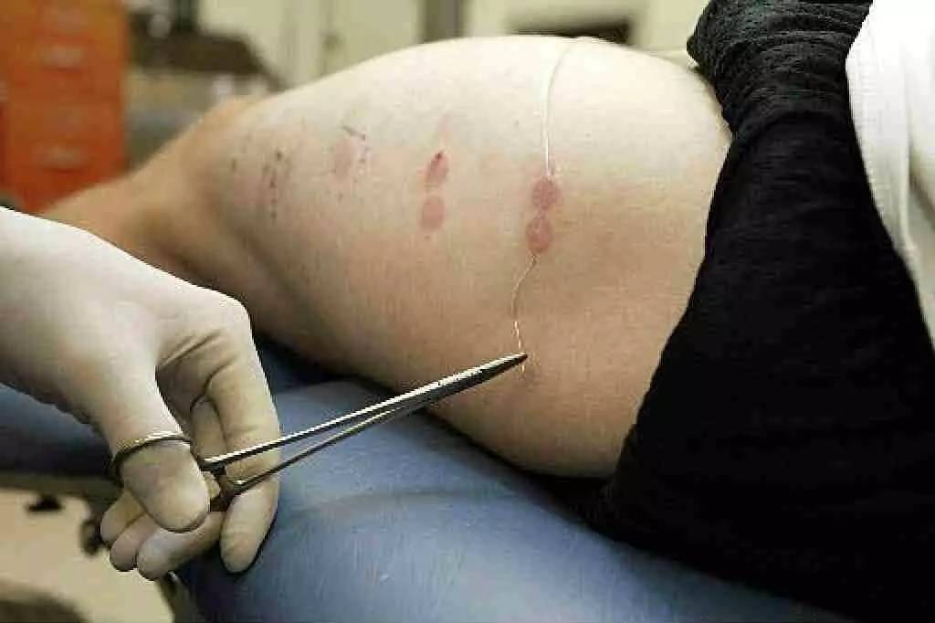 疼痛研究最新进展,疼痛阈值与疼痛的关系