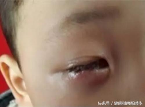 孩子误吞干燥剂，别慌，要先确定是哪一种！（干货收藏版）