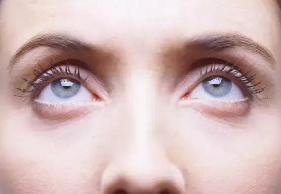 卧蚕眼袋黑眼圈傻傻分不清楚,卧蚕与眼袋别傻傻分不清楚