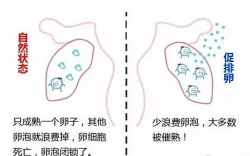 试管婴儿促排卵最佳方案,试管婴儿促排卵长方案详细讲解