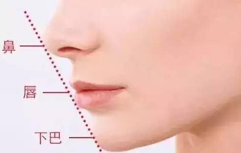 玻尿酸填充下巴一针还是两针好,玻尿酸丰下巴后要注意哪些问题