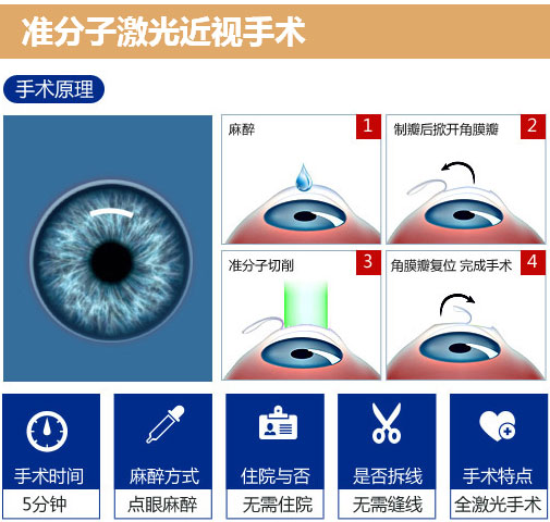 近视眼手术目前有几种方式,做近视眼手术全过程自己知道吗