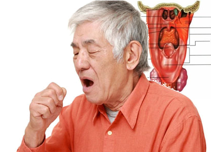 咽喉炎怎么治疗除根,万应胶囊治疗咽喉炎