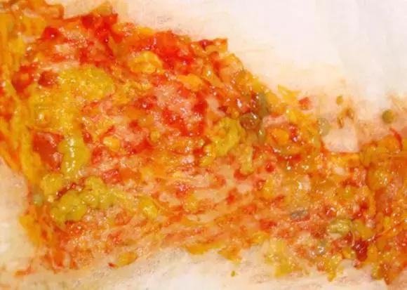 关于宝宝大便的11种性状,宝宝大便6种形状