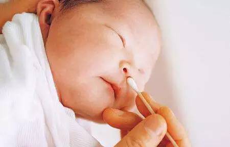 新生儿需要注意的事项和保养,新生儿照顾重点