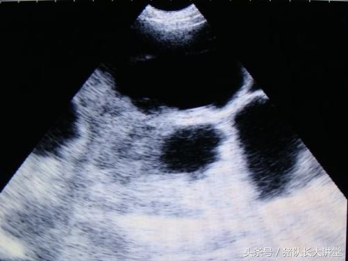 教你如何判断母猪是否怀孕,猪队长大讲堂