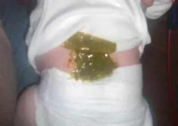 关于宝宝大便的11种性状,宝宝大便6种形状