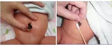 新生儿需要注意的事项和保养,新生儿照顾重点