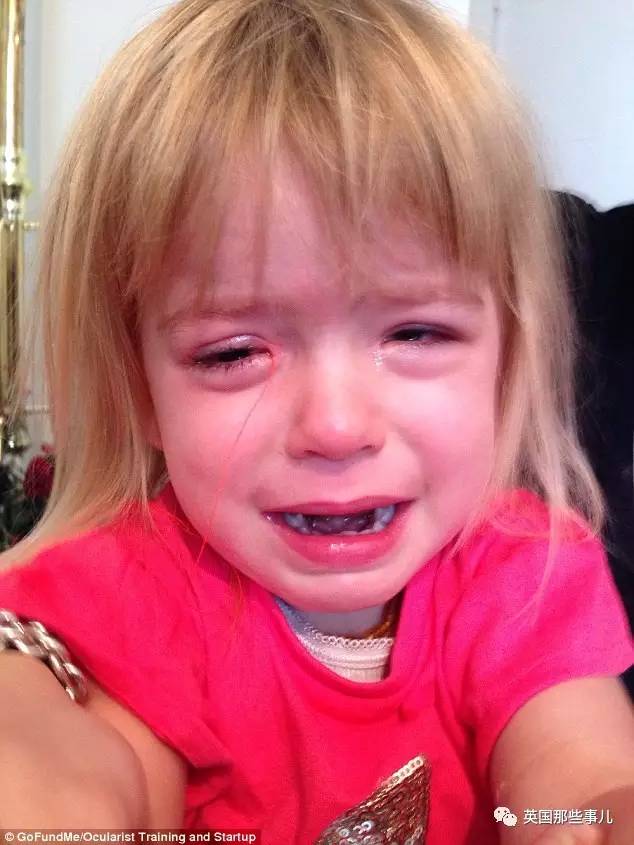 自己学做眼珠子的老爹……为了女儿，父亲们真的什么都能做到！