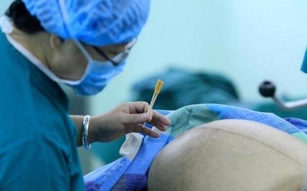 生娃前刮毛叫什么,生孩子必须要剔除体毛吗