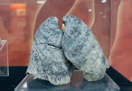 东西脏到衣服该如何清洗,白衣服脏了能用肥皂洗干净吗