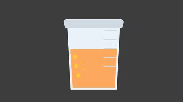 关于尿液中有泡沫科普,科普尿液的形成