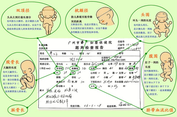 孕期如何快速看懂b超单,整个孕期b超究竟都能查出些什么