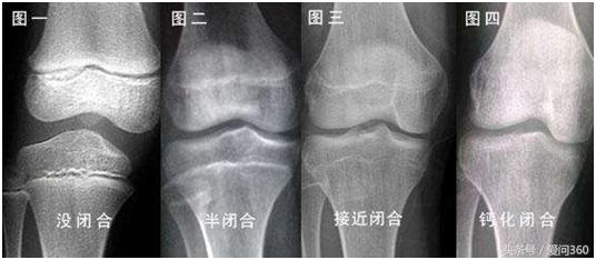 20岁还像个小孩子能长高吗,20岁还能长高么男