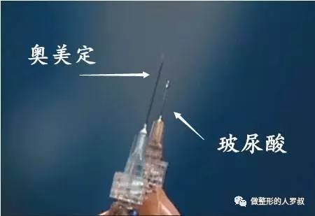 罗叔：10问玻尿酸（建议收藏）