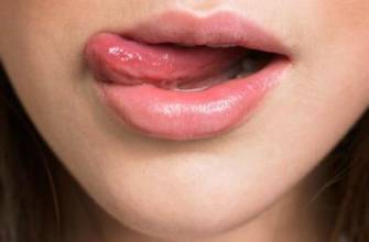 嘴唇上火起皮最快最有效的方法,上火引起的嘴唇干裂起皮怎么治