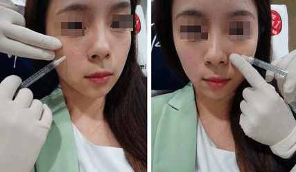 鐜诲翱閰稿埌搴曡兘涓嶈兘澶氭墦,鎵撶幓灏块吀鍒板簳鏈夊鐥涜嫤