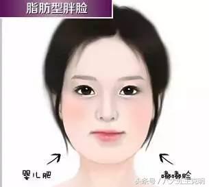 瘦脸针三次真的能定型吗,瘦脸针打三次就可以永久定型了吗