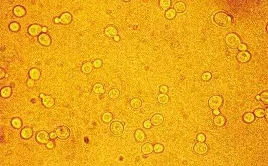 揭开酵素的神秘面纱,橙子酵素是什么