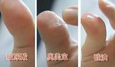 药店买的注射液怎么鉴定真假,注射产品鉴定真伪