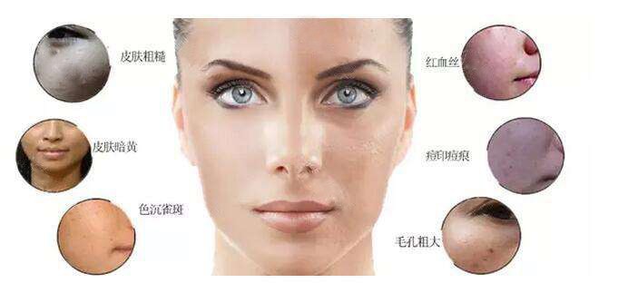 皮肤敏感泛红怎么选择光子嫩肤,油性皮肤怎么推荐光子嫩肤