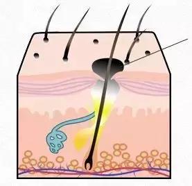 有效去黑头的方法让你摆脱草莓鼻,去黑头草莓鼻最有效的方法