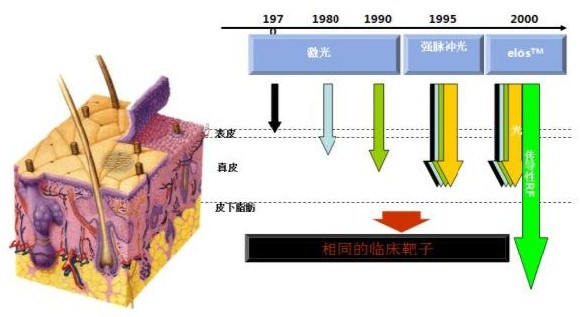 皮肤敏感泛红怎么选择光子嫩肤,油性皮肤怎么推荐光子嫩肤