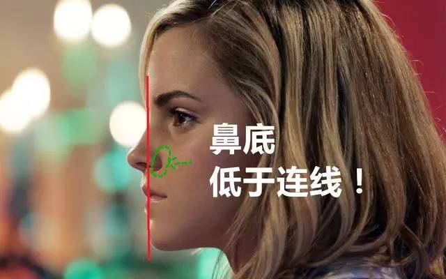 美女与野兽｜天生法令纹只能靠整容吗？那是因为你没看这篇！