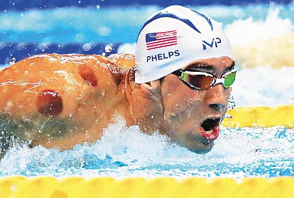 还记得巴西奥运会上，美国飞鱼菲尔普斯背上的种的大草莓吗？