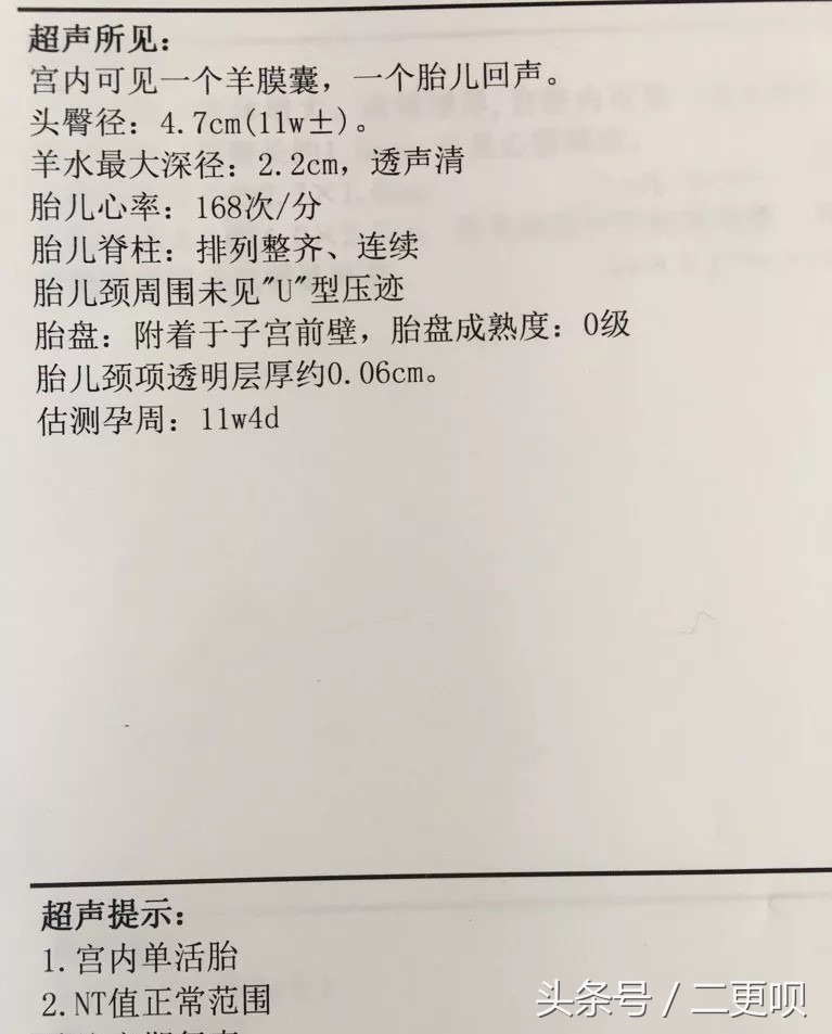nt检查11周去还是12周去比较好,孕12-16周做nt检查需要注意什么
