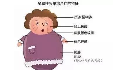 女性肥胖会导致多囊卵巢,多囊卵巢综合症怎么治疗怀孕快