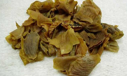 保守治疗胆结石有什么偏方可以治,胆结石有没有偏方治疗