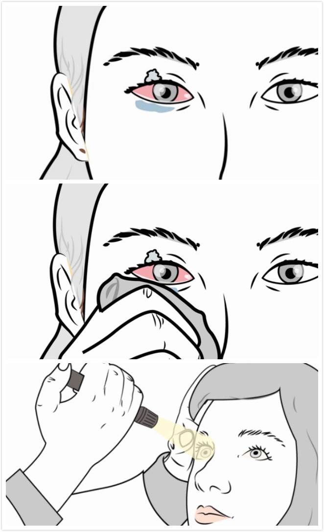 怎样祛强力胶,简单去除强力胶渍的方法