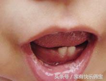 宝宝喉咙里长了小白点是什么病,宝宝嘴里有一层白膜是什么原因