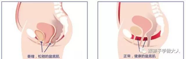 准妈妈顺产运动,准妈妈运动好处