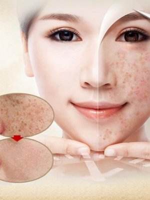 用什么在家做面膜最补水效果最好,在家用什么做面膜美白保湿去皱