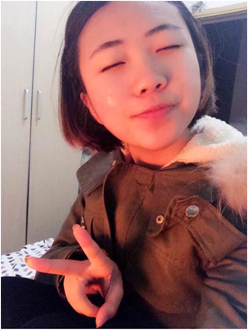 长痘痘黑头粉刺注意什么,青春期脸上长痘痘饮食注意什么