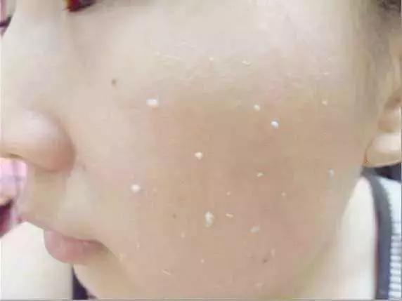 用贵仙仙的护肤品脸上也搓泥？你的护肤程序可能错了！