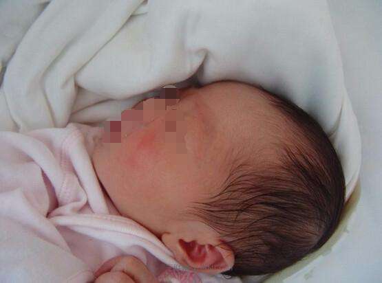 一层层，一刀刀切开孕妇肚子，剖腹产并不是你想象的那么简单