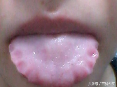 怎样判断体内有湿气的表现,怎样判断体内有湿气