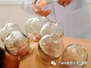 后背刮痧拔罐有祛湿的效果吗,先刮痧拔罐再艾灸祛湿气吗