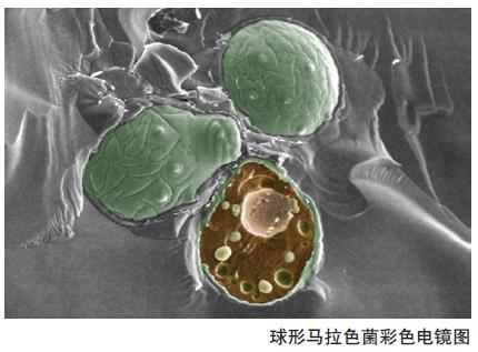 头皮屑到底是什么啊,原来头皮屑是怎么来的