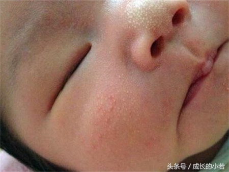 新手妈妈看到自己宝宝就烦,新生儿7个常见的生理现象