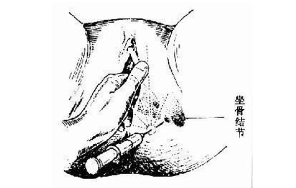 关于会阴侧切的真相，医生不一定会全告诉你！