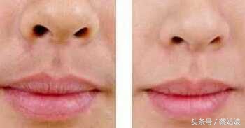 青春期唇毛很难看,孩子唇毛多难看怎么办