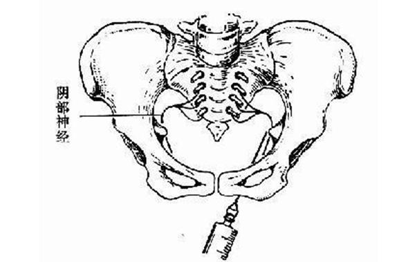 关于会阴侧切的真相，医生不一定会全告诉你！