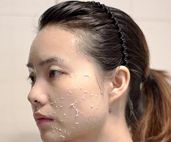 混合性皮肤怎么去角质,怎样去角质护肤