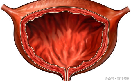 尿不尽怎么治疗最快的方法,导致尿不尽的原因有哪些