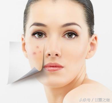 甘露之吻,甘露之吻护肤方法