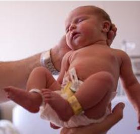 换血婴儿熊猫血,熊猫血宝宝溶血换血危险吗